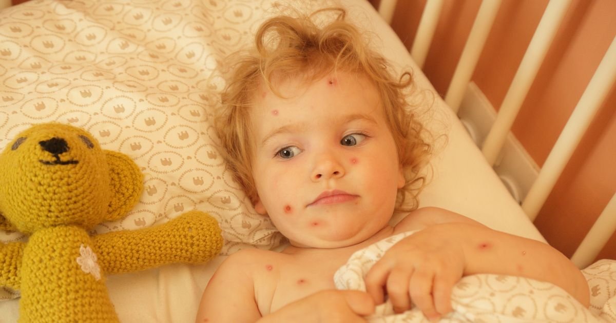 The best known chicken symptom that could be a sign your child has infection