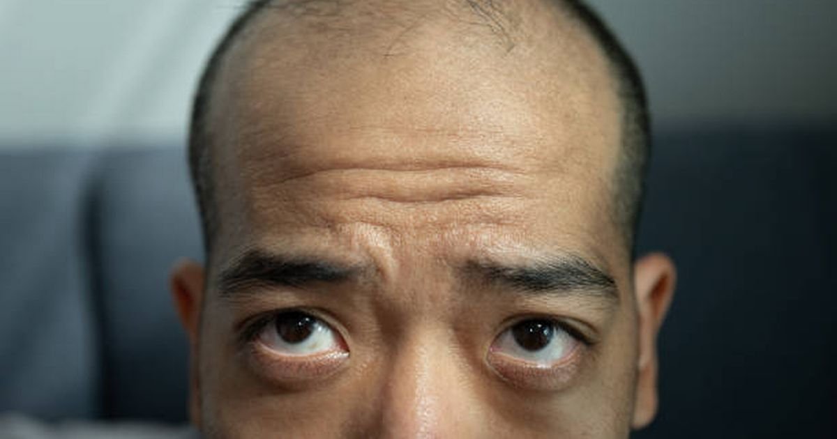 How to fix your hair of end - and discover why he fell in the first place