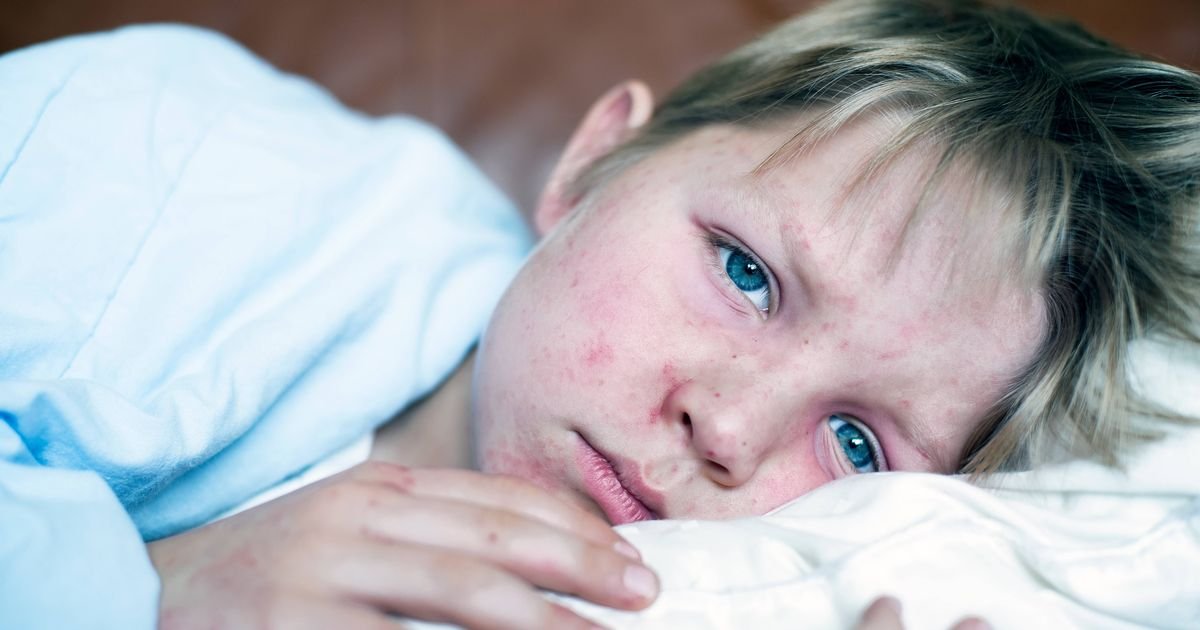 The pharmacist says "Stay at home 'if you have measures like cases they grow across Europe